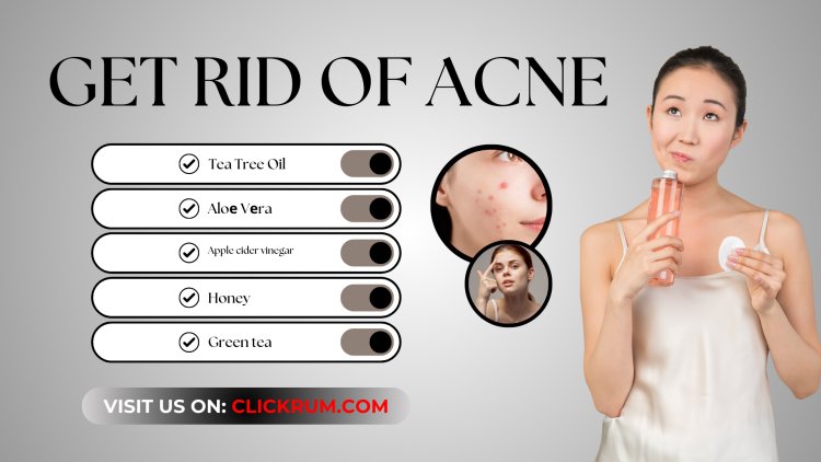 Get Rid Of Acne - Best Natural Remedies for Acne Treatment